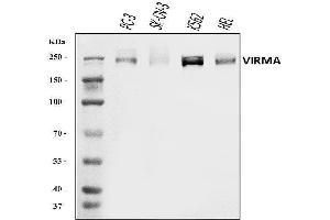 Western blot analysis of KI/VIRMA using anti-KI/VIRMA antibody (ABIN7599707). (Protein Virilizer Homolog (VIRMA) (AA 11-1529) anticorps)