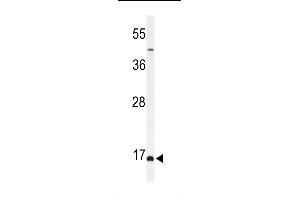 Western blot analysis of FB Antibody (C-term) (ABIN653927 and ABIN2843161) in MCF-7 cell line lysates (35 μg/lane).