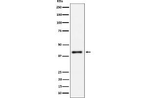 Western blot analysis of IL15RA expression in Raji cell lysate.