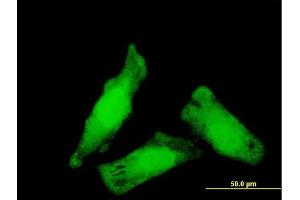 Immunofluorescence of monoclonal antibody to NIPBL on HeLa cell.