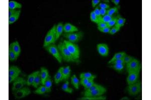 Immunofluorescence staining of HepG2 cells with ABIN7170935 at 1:100, counter-stained with DAPI.
