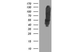 HEK293T cells were transfected with the pCMV6-ENTRY control (Left lane) or pCMV6-ENTRY DLD (Right lane) cDNA for 48 hrs and lysed. (DLD anticorps)