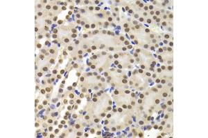 Immunohistochemistry of paraffin-embedded mouse kidney using PPP1R8 Antibody (ABIN5974046) at dilution of 1/100 (40x lens). (PPP1R8 anticorps)