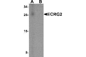 Western blot analysis of ECRG2 in human lung tissue lysate with ECRG2 antibody at 1 µg/mL in (A) the absence and (B) the presence of blocking peptide. (SPINK7/ECRG2 anticorps  (C-Term))