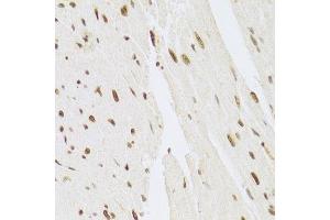 Immunohistochemistry of paraffin-embedded mouse heart using MAPK3 Antibody.