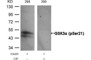 Western blot analysis of extracts from 293 cells, treated with insulin or calf intestinal phosphatase (CIP), using GSK3α (Phospho-Ser21) Antibody. (GSK3 alpha anticorps  (pSer21))