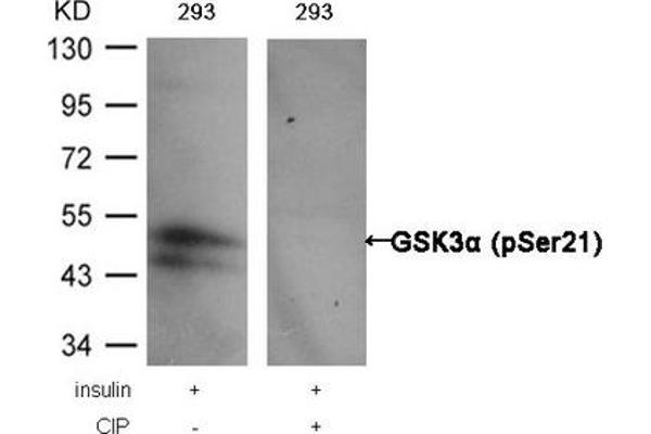 GSK3 alpha anticorps  (pSer21)