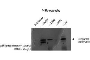 SETDB1 activity assay.
