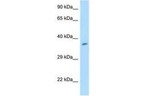 Chromosome 7 Open Reading Frame 20 (C7orf20) (AA 32-81) anticorps