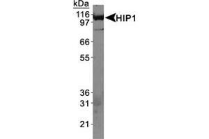 Western Blot Analysis of HIP1 in HeLa whole cell extracts using HIP1 monoclonal antibody, clone 4B10 .