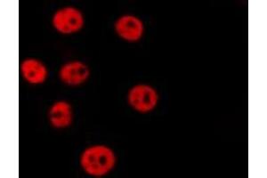 ABIN6267508 staining MCF7 by IF/ICC.