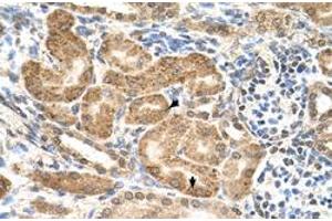 Immunohistochemical staining (Formalin-fixed paraffin-embedded sections) of human kidney with GMPPB polyclonal antibody  at 4-8 ug/mL working concentration.