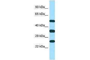WB Suggested Anti-RAET1E Antibody Titration: 1. (Retinoic Acid Early Transcript 1E (RAET1E) (C-Term) anticorps)