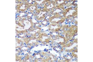Immunohistochemistry of paraffin-embedded Mouse kidney using HEBP2 Rabbit pAb (ABIN7267604) at dilution of 1:100 (40x lens).