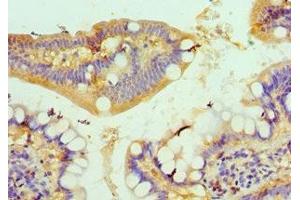 Immunohistochemistry of paraffin-embedded human small intestine tissue using ABIN7149059 at dilution of 1:100 (KAT14 anticorps  (AA 523-782))