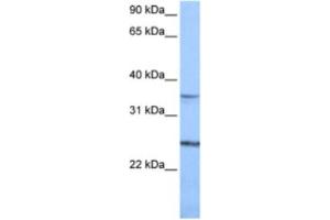 Western Blotting (WB) image for anti-Phosphatidylinositol Glycan F (PIGF) antibody (ABIN2462126)