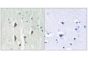 Immunohistochemistry analysis of paraffin-embedded human brain tissue, using PAK1/2/3 (epitope around residue 423/402/421) antibody.