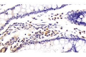 Detection of KMO in Human Colon Tissue using Polyclonal Antibody to Kynurenine-3-Monooxygenase (KMO) (KMO anticorps  (AA 1-374))