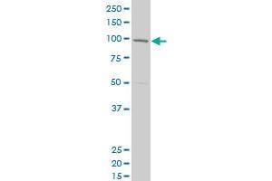 CPSF2 polyclonal antibody (A01), Lot # 061101JCS1 Western Blot analysis of CPSF2 expression in SJCRH30 .