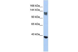 WB Suggested Anti-SMARCA1 Antibody Titration:  0.