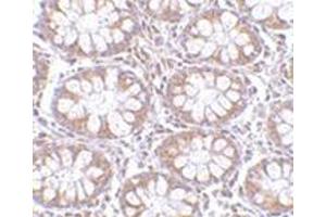 Immunohistochemistry of TEM1 in human colon tissue with this product at 2. (CD248 anticorps  (C-Term))