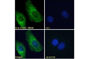 ABIN185182 Immunofluorescence analysis of paraformaldehyde fixed U2OS cells, permeabilized with 0.