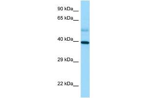 Western Blotting (WB) image for anti-Stimulated By Retinoic Acid 8 (STRA8) (C-Term) antibody (ABIN2789683) (STRA8 anticorps  (C-Term))