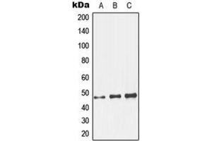 Western blot analysis of GCNT7 expression in HeLa (A), mouse kidney (B), rat kidney (C) whole cell lysates.