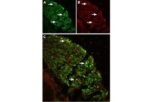 Expression of TRPV2 in mouse DRG - Immunohistochemical staining of TRPV2 in mouse dorsal root ganglion (DRG) using Anti-TRPV2 (VRL1) (extracellular) Antibody (ABIN7043845, ABIN7044002 and ABIN7044003).