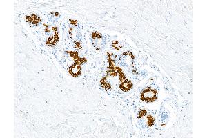 Immunohistochemistry (IHC) image for anti-Keratin 19 (KRT19) antibody (ABIN7449419)