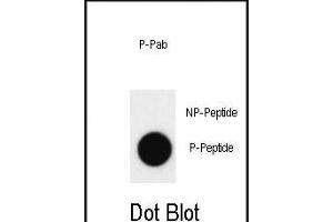 Dot blot analysis of Phospho-ABL1/ABL2(439)Antibody Pab (ABIN389506 and ABIN2839561) on nitrocellulose membrane.