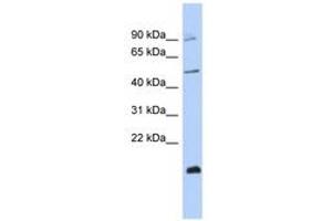 Image no. 1 for anti-Zinc Finger Protein 645 (ZNF645) (C-Term) antibody (ABIN6742924)