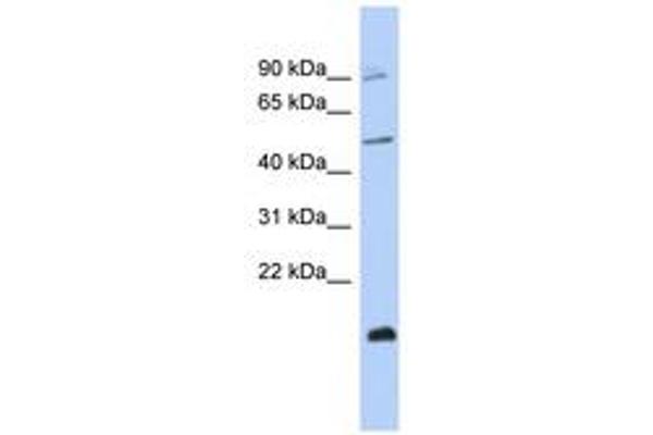ZNF645 antibody  (C-Term)