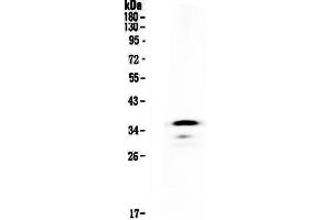 Western blot analysis of CD40 using anti-CD40 antibody . (CD40 anticorps  (AA 24-193))
