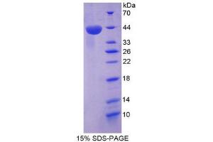SDS-PAGE (SDS) image for Chemokine (C-X-C Motif) Ligand 12 (CXCL12) (AA 23-89) protein (His tag,GST tag) (ABIN1980661)