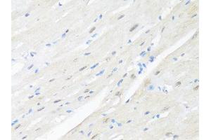 Immunohistochemistry of paraffin-embedded mouse heart using RBFOX3 antibody (ABIN1874561) at dilution of 1:100 (40x lens). (NeuN anticorps)
