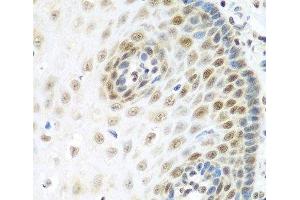 Immunohistochemistry of paraffin-embedded Human esophagus using MDC1 Polyclonal Antibody at dilution of 1:100 (40x lens). (MDC1 anticorps)