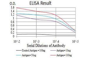 Black line: Control Antigen (100 ng),Purple line: Antigen (10 ng), Blue line: Antigen (50 ng), Red line:Antigen (100 ng)