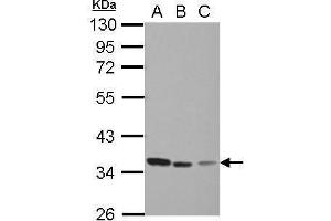 WB Image Sample (30 ug of whole cell lysate) A: Jurkat B: Raji C: THP-1 10% SDS PAGE antibody diluted at 1:1000 (TYMS anticorps)