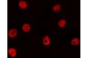 ABIN6275111 staining Hela by IF/ICC.