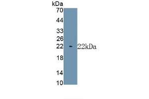 Detection of Recombinant MYH7, Human using Monoclonal Antibody to Myosin Heavy Chain 7, Cardiac Muscle, Beta (MYH7)