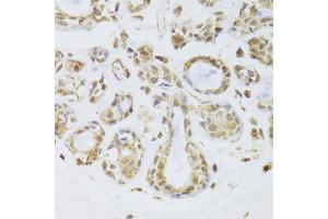 Immunohistochemistry of paraffin-embedded human breast using ILF2 Antibody (ABIN5973487) at dilution of 1/100 (40x lens). (ILF2 anticorps)