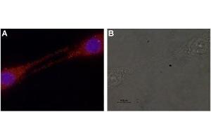 Expression of GDNF in rat C6 glioma cells - Immunocytochemical staining of GDNF in rat C6 glioma cells.