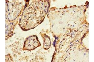Immunohistochemistry of paraffin-embedded human placenta tissue using ABIN7171008 at dilution of 1:100 (SOCS6 anticorps  (AA 1-210))