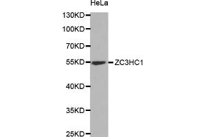 Western blot analysis of extracts of HeLa cells, using ZC3HC1 antibody (ABIN5973745) at 1/1000 dilution. (ZC3HC1 anticorps)