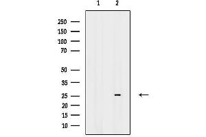 anti-Zinc Finger Protein 230 (ZNF230) (Internal Region) antibody
