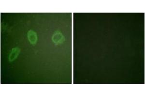 Immunofluorescence analysis of HuvEc cells, using HER2 (Ab-686) Antibody. (ErbB2/Her2 anticorps  (AA 661-710))