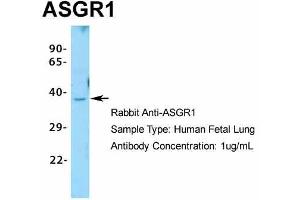 Host:  Rabbit  Target Name:  ASGR1  Sample Type:  Human Fetal Lung  Antibody Dilution:  1. (Asialoglycoprotein Receptor 1 anticorps  (N-Term))