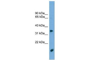 TMPRSS3 antibody used at 1 ug/ml to detect target protein. (TMPRSS3 anticorps  (N-Term))