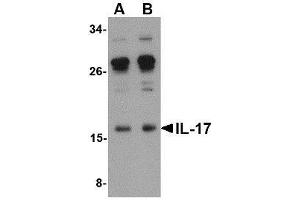 Western blot analysis of IL-17 in A-20 lysate with AP30410PU-N IL-17 antibody at (A) 0. (Interleukin 17a anticorps  (Center))